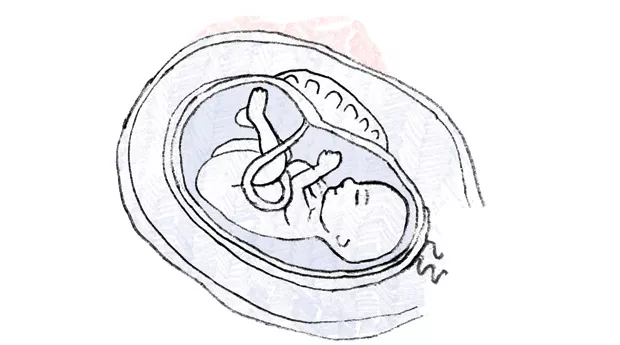 Sikiön raskausviikko 20 rv 20 kuva