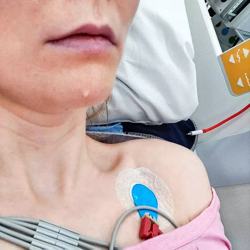 Sonja-Elina Tähtinen sairaalasängyssä letku rintaansa kiinnitettynä. 