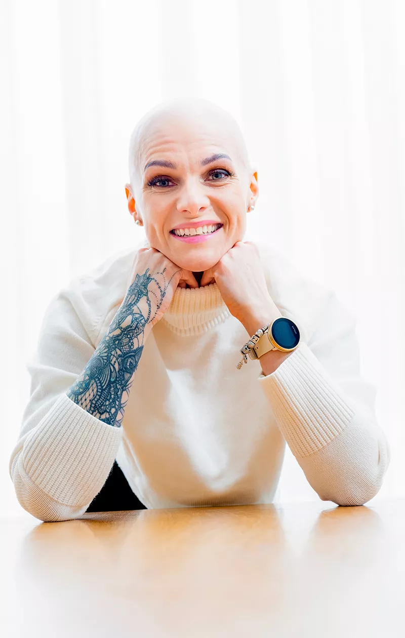 Alopecia vei Ann-Marie Heiskaselta hiukset.