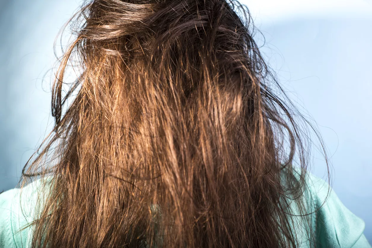 Hair slugging ei ole menetelmänä uusi. Hoidolla on pitkät perinteet muun muassa Etelä-Aasian kulttuureissa.