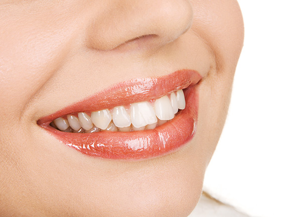 Kaunis hymy paikka-aineella – Näin saat suorat hampaat ilman oikomishoitoa